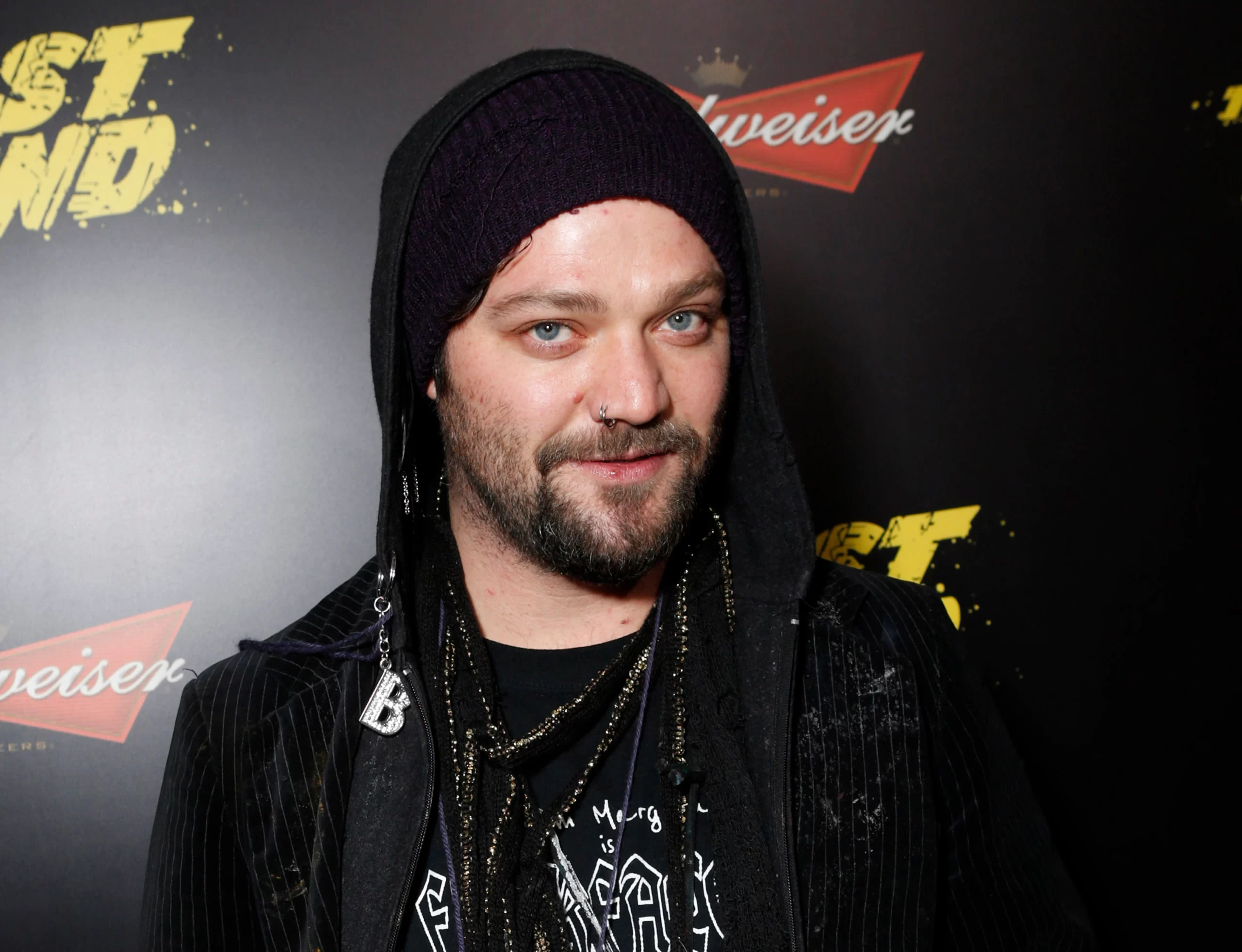 Who Is Bam Margera? Is Bam Margera Dead Or Still Alive? Check Cause Of Death