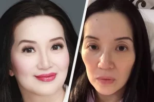 Kris Aquino image