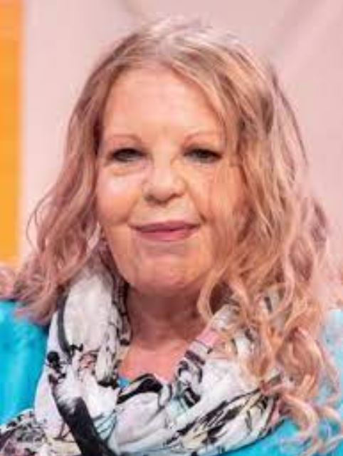 Sally Thomsett’s illness is what kind? Facts About Face Surgery And Transformation Here